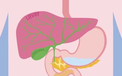 Duodenitis, ontstoken twaalfvingerige darm